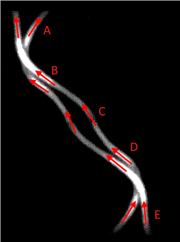 parallel filaments